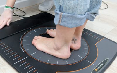 ¿Qué es el Pie Cavo y Cómo Tratarlo?