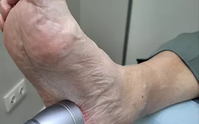 Dolor en el Talón: Todo lo que Necesitas Saber para Identificarlo y Tratarlo