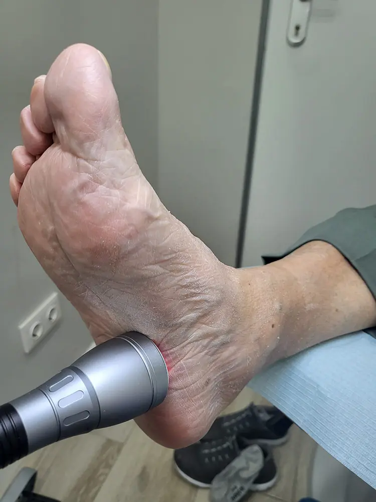 Terapia Laser en Francos Rodriguez