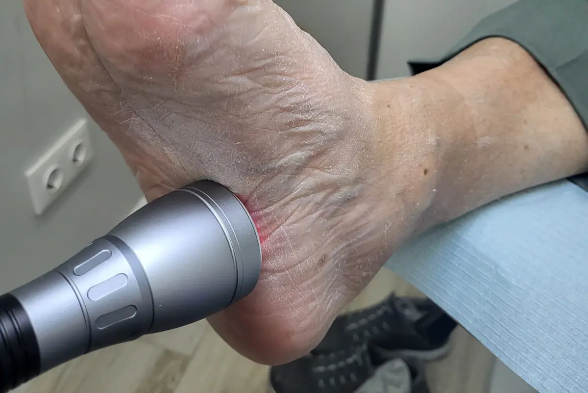 Terapia Laser en Francos Rodriguez